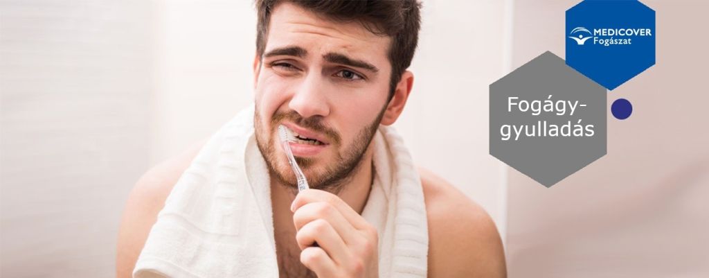 Milyen tünetei vannak a fogágygyulladásnak?