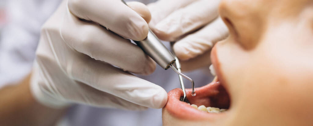 Miért fontos a rendszeres fogászati szűrővizsgálat?